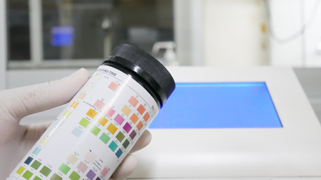 Urine reader meter analysis in withe laboratory.の写真素材