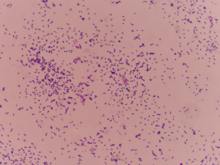 gram stain test showing bacteria cells in medical background concept.の写真素材