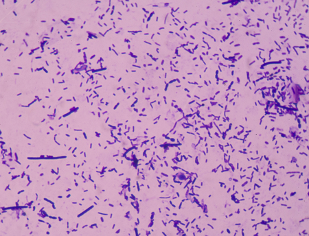 Moderate bacteria cells with Gram stain method fide with microscope.の写真素材