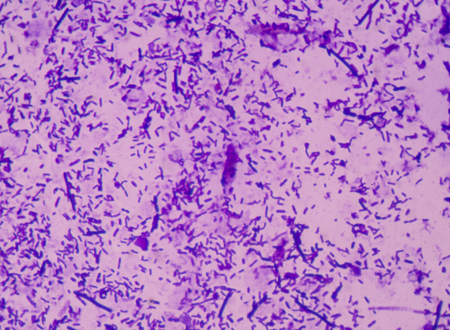 moderate bacteria cells with Gram stain method fide with microscope.の写真素材