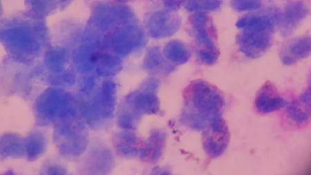 Close up abnormal blood cells abstract background.