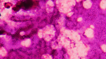 Close up abnormal blood cells abstract background.の写真素材