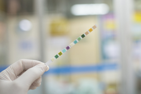 Laboratory Urine analysis on blurred background.の写真素材