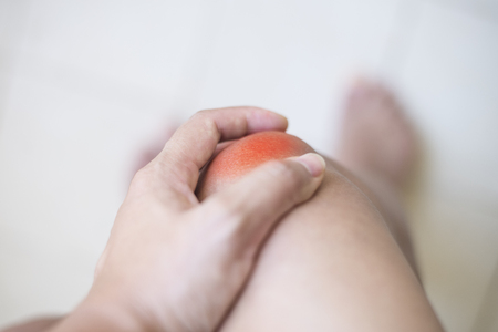 Arthritis knee joint get hurt and pain.の写真素材