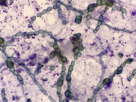 Macro budding yeast cells finding with microscope.Science concept.