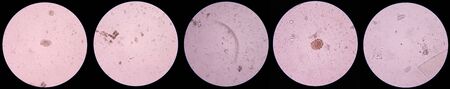 Mixed parasite egg ang larva stage.medical science concept.