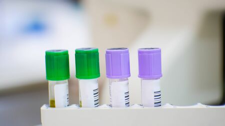 EDTA purple test tube compleate blood count test and lithium heparin green test tube for blood...