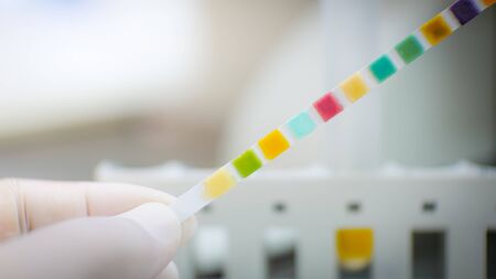 Urine strip test on blurred background medicsl science concept.の写真素材