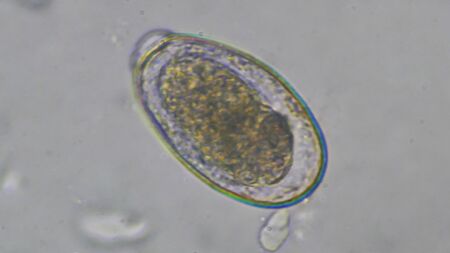 Photo Of Macro Gnathostoma Spinigerum Id Royalty Free Image Stocklib