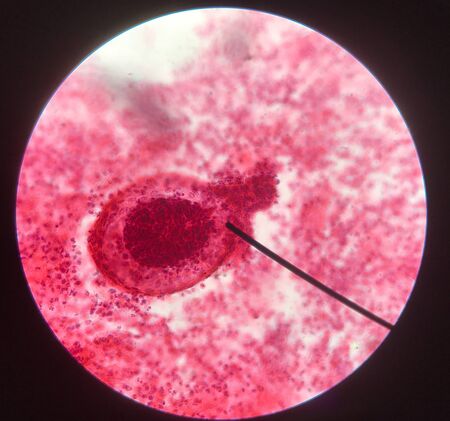Cells in reproductive female cytology and histology education concept.