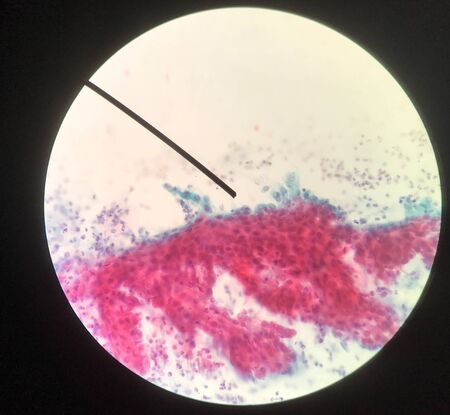 Cells in reproductive female cytology and histology education concept.