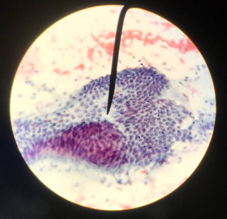 Cells in reproductive female cytology and histology concept medical science.