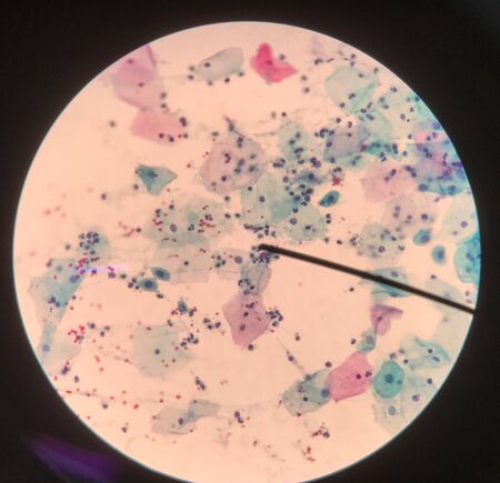 Cells in reproductive female cytology and histology education concept.