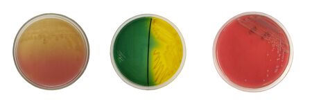 Close up media culture bacteria on white background.
