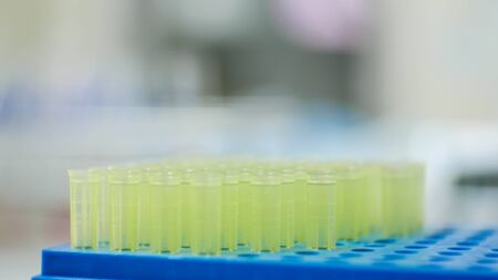 Blurred yellow pipette tip in blue box.