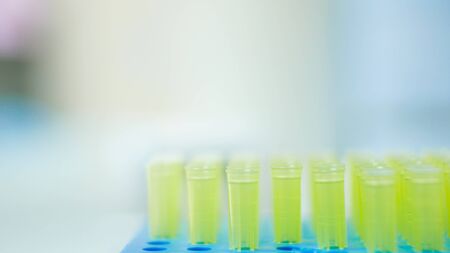 Blurred pipette tips in box on blur background.の写真素材