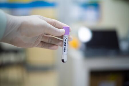 Close up hand hold test-tube of blood coronavirus.