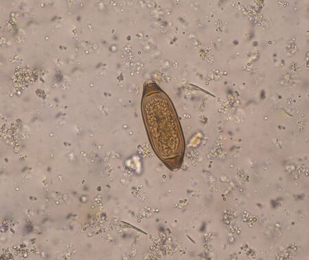 Egg parasite in stool exam laboratory concept.