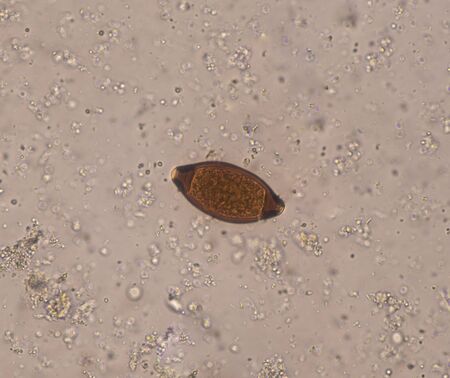 Egg parasite in stool exam laboratory concept.