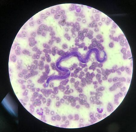 Blood parasite microphilaria on red blood cells background.の写真素材