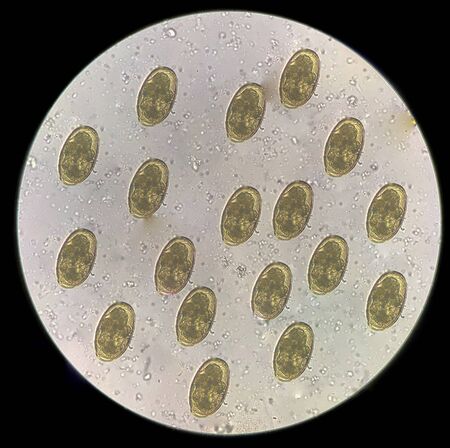 Moderate eggs of parasite in stool examination laboratory science concept.