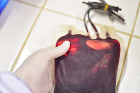Close up blood bag laboratory.