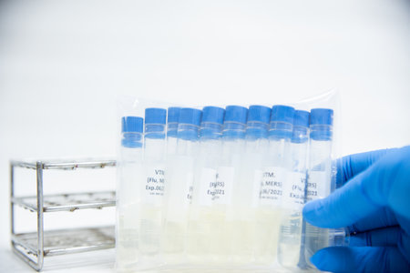 Viral transportation media (VTM)specimen collection  with scientist and blue glove.