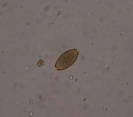 Trichulis trichiura egg in stool exam.の写真素材