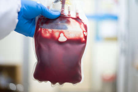Close up Blood bag in blood bank laboratory.の写真素材