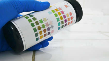 Chemical Srip test urinalysis in laboratory.の写真素材