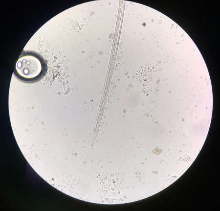 Close up parasite in stool exam.