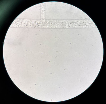 Fresh spermatozoa in urine sediment in laboratory.の写真素材