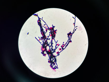 Budding yeast with pseudo hephae in urine Gram stain.の写真素材