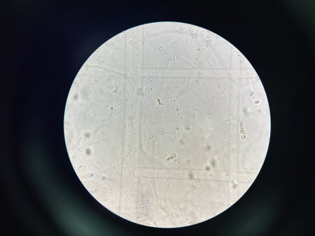 Budding yeast with pseudo hephae in urine laboratory.の写真素材