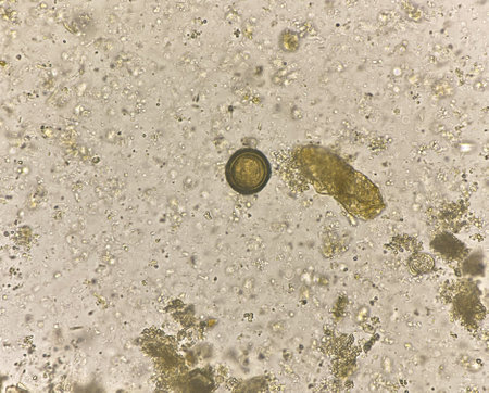 Teania egg human parasite in stool examination.