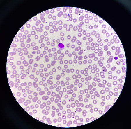 Lymphocyt WBC on red blood cell background.medical background.の写真素材