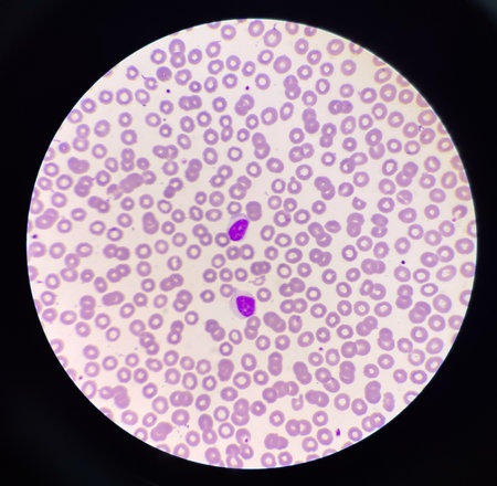 Lymphocyt WBC on red blood cell background.medical background.の写真素材