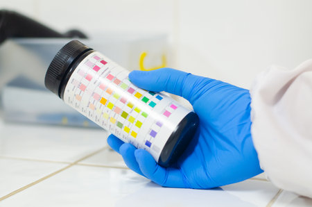 Urinalysis testing Urine strip 11 test in laboratory.の写真素材