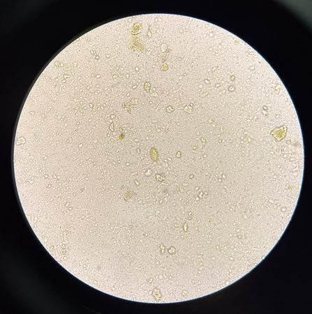 Parasite O.V. egg in stool exam.の写真素材
