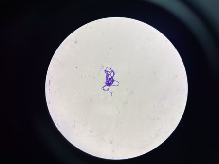 Gram stain.Gram positive cocci in chain in sputum sample.の写真素材