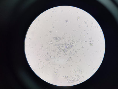 Budding yeast cell in nature smear in environment.の写真素材
