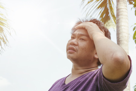 A man are heat stroke on the sunの写真素材