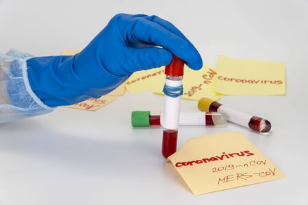 Hand holding blood sample in vacuum tube. Positive test result for the new rapidly spreading Coronavirusの写真素材
