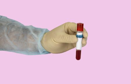 Hand holding blood sample in vacuum tube. Positive test result for the new rapidly spreading...