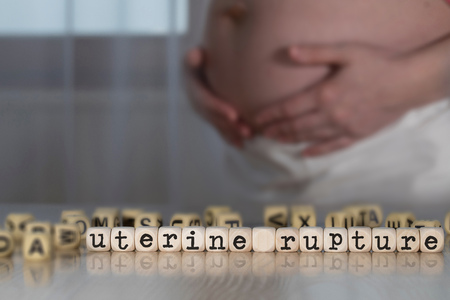 Words UTERINE RUPTURE composed of wooden letters. Pregnant woman in the backgroundの写真素材