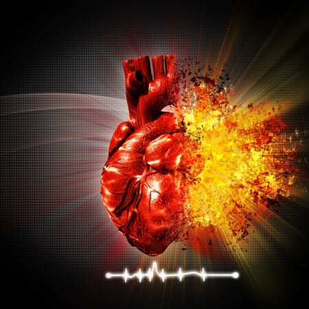 heart attack. abstract medical and health care backgroundsの写真素材