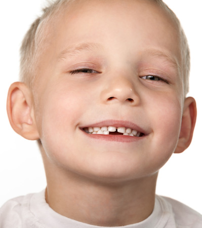 Close-up portrait of child. Missing teeth.