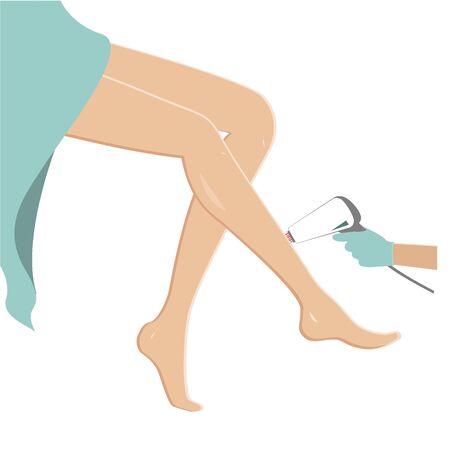 Female legs hair removal. Laser epilation concept, vector illustrationのイラスト素材