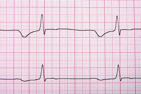 ecg graphの写真素材