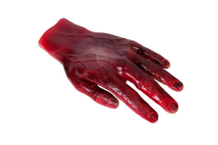 Burned hand first aid training prop isolated on white backgroundの写真素材